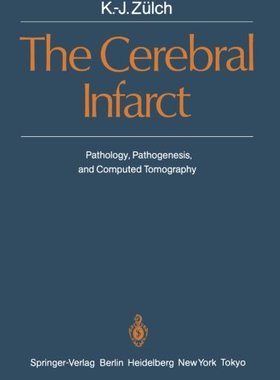 【预订】The Cerebral Infarct: Pathology, Pat...