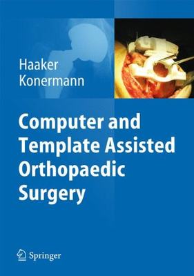 【预订】Computer and Template Assisted Ortho...