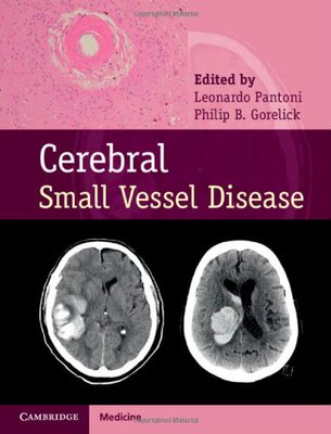 【预订】Cerebral Small Vessel Disease