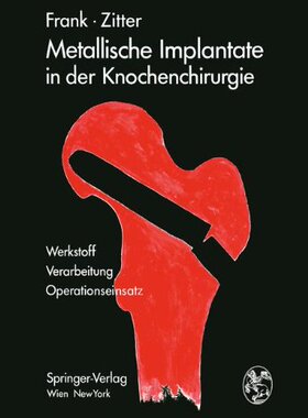 【预订】Metallische Implantate in Der Knoche...