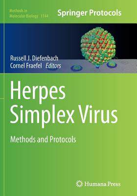 【预订】herpes simplex virus: methods and pr.