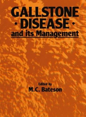 【预订】Gallstone Disease and Its Management