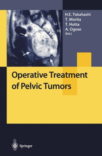 【预订】Operative Treatment of Pelvic Tumors 书籍/杂志/报纸 科普读物/自然科学/技术类原版书 原图主图