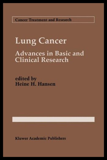 【预售】Lung Cancer: Advances in Basic and Clinical Resea