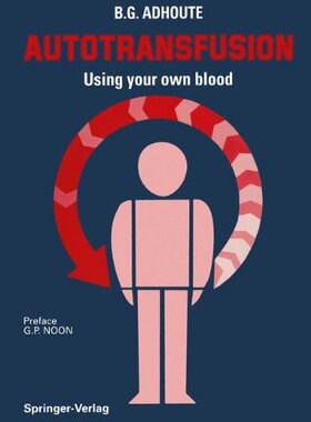【预售】Autotransfusion: Using Your Own Blood