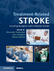 【预订】Treatment-Related Stroke