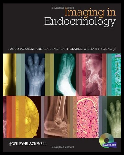 【预售】Imaging in Endocrinology