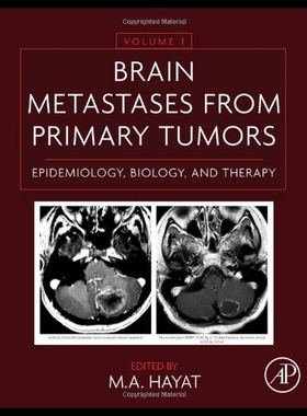 【预售】Brain Metastases from Primary Tumors: Epidemiolog