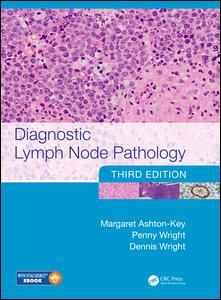 【预订】Diagnostic Lymph Node Pathology