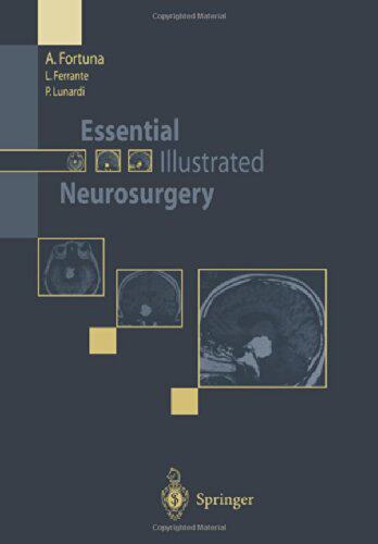 【预订】Essential Illustrated Neurosurgery