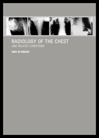 【预售】Radiology of the Chest and Related Conditions