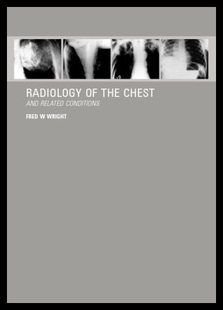 Radiology 预售 the Related and Chest Conditions