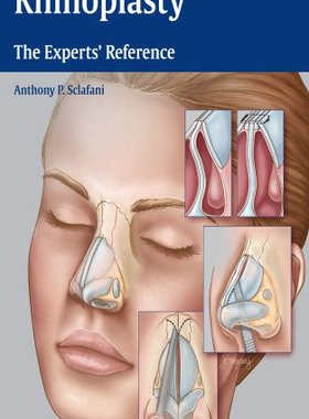 【预售】Rhinoplasty: The Experts' Reference