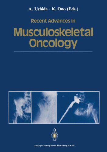 【预订】Recent Advances in Musculoskeletal O...