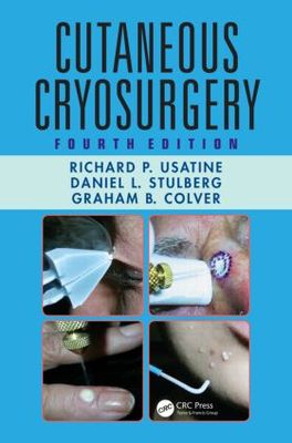 【预售】Cutaneous Cryosurgery, Fourth Edition