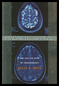 【预售】Magnetic Appeal: MRI and the Myth of Transparency