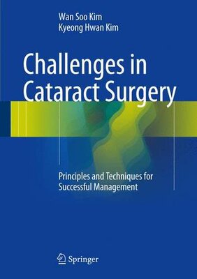 【预订】Challenges in Cataract Surgery: Prin...
