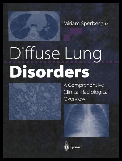 【预售】Diffuse Lung Disorders: A Comprehensive Clinical-