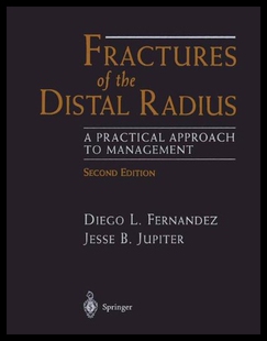 【预售】Fractures of the Distal Radius: A Practical Appro