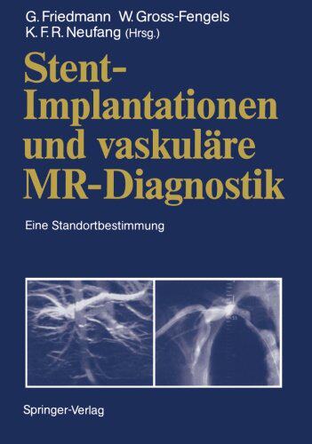【预订】Stent-Implantationen Und Vaskulare M...