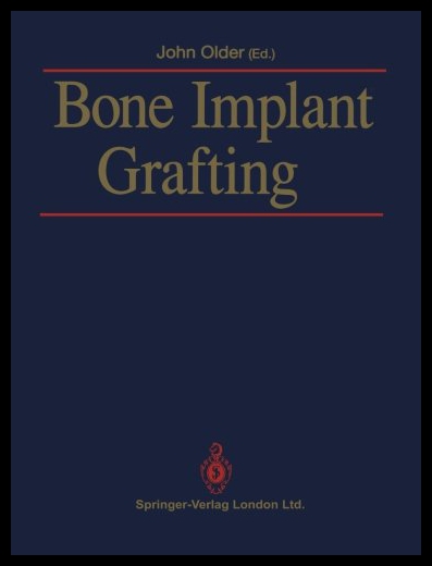 【预售】Bone Implant Grafting