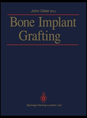【预售】Bone Implant Grafting