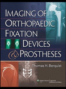 【预售】Imaging of Orthopaedic Fixation Devices and Prost