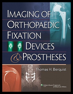 Prost Imaging Devices and Fixation 预售 Orthopaedic