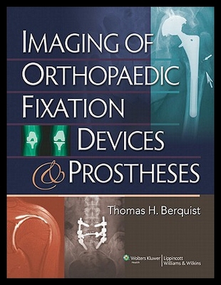 【预售】Imaging of Orthopaedic Fixation Devices and Prost