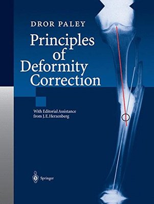 【预订】Principles of Deformity Correction