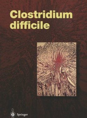 【预订】Clostridium Difficile