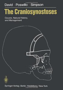 【预售】The Craniosynostoses: Causes, Natural History, an...