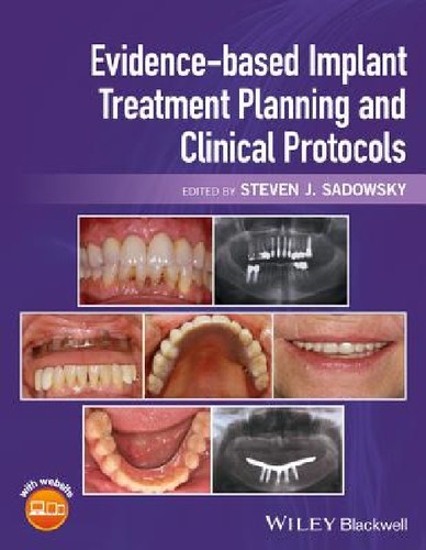 【预订】Evidence-Based Implant Treatment Pla...