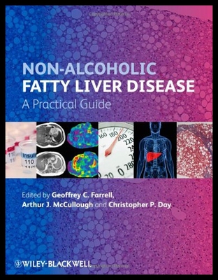 【预售】Non-Alcoholic Fatty Liver Disease: A Practical Gu