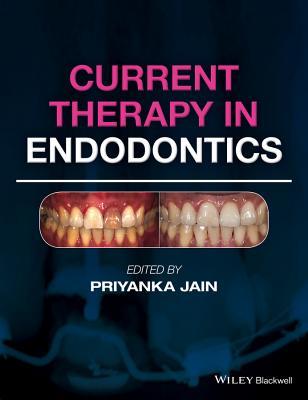 【预订】Current Therapy in Endodontics