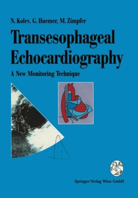 【预订】Transesophageal Echocardiography: A ...