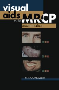 【预订】Visual AIDS to the MRCP Examination