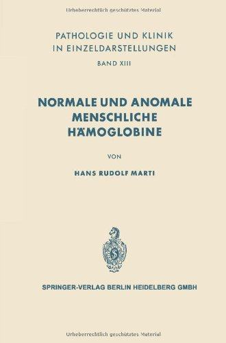美国库房发货,通常付款后5-8周到货！