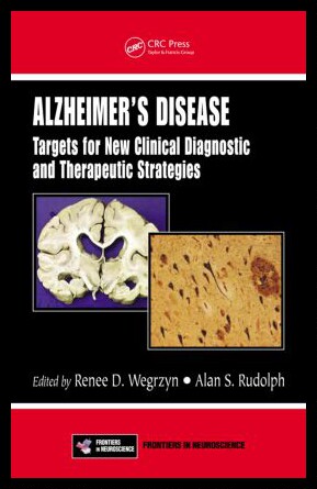 【预售】alzheimers disease.