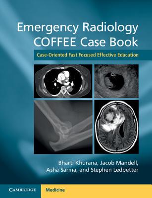 【预订】Emergency Radiology COFFEE Case Book