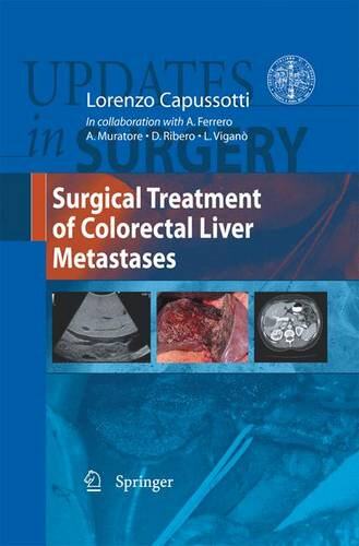 【预订】Surgical Treatment of Colorectal Liv...