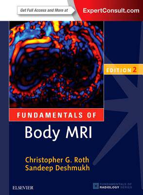 【预订】Fundamentals of Body MRI