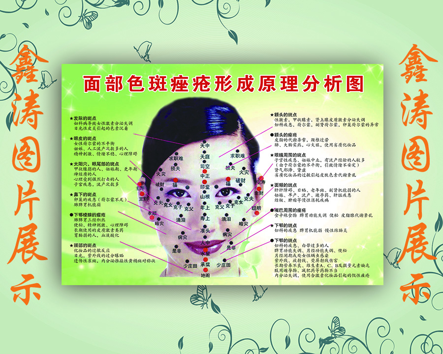 中医文化海报写真广告贴纸挂图kt板子面部色斑形成原因分析图简介