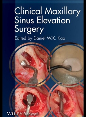 【预售】Clinical Maxillary Sinus Elevation Surgery