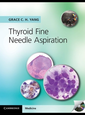 【预售】Thyroid Fine Needle Aspiration with CD Extra