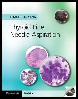 【预售】Thyroid Fine Needle Aspiration with CD Extra
