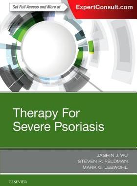 【预订】Therapy for Severe Psoriasis