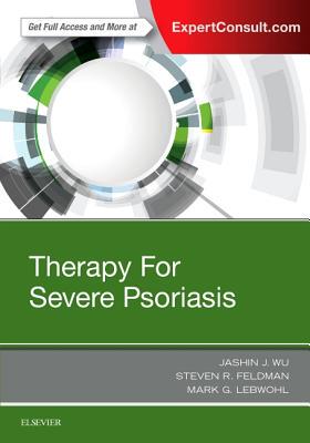 【预订】Therapy for Severe Psoriasis