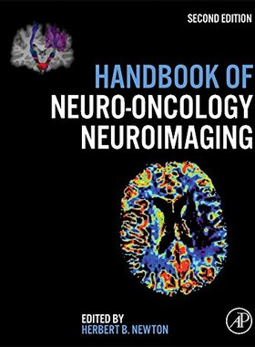 【预订】Handbook of Neuro-Oncology Neuroimaging