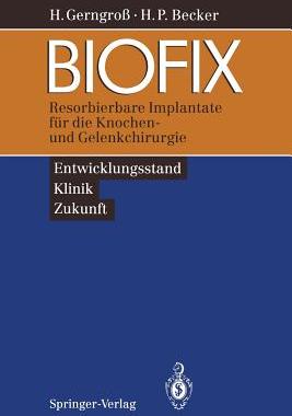 【预订】Biofix: Resorbierbare Implantate Fur...